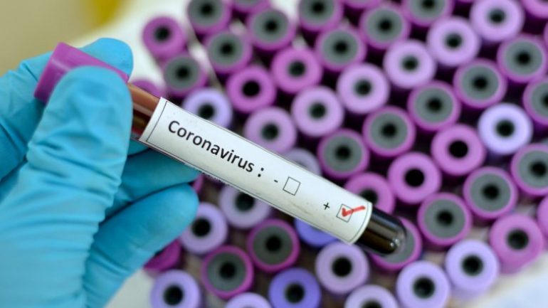 Coronavirus2-780x439-770x433.jpg
