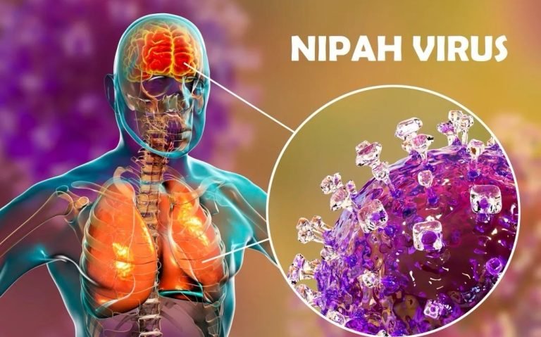 Alarm nga OBSH për virusin Nipah, çfarë është dhe sa të rrezikuar jemi! Shtatë pyetje dhe përgjigje që duhet të dimë