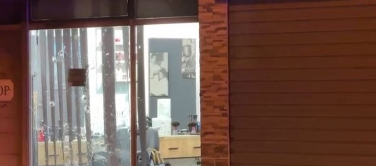EMRI/ Breshëri plumbash në berberhane, identifikohet 30-vjeçari që u plagos, ja si është gjendja shëndetësore