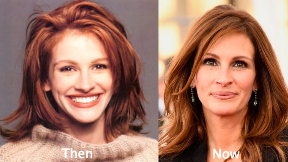 Julia-Roberts-Plastic-Surgery-Before-and-After.jpg